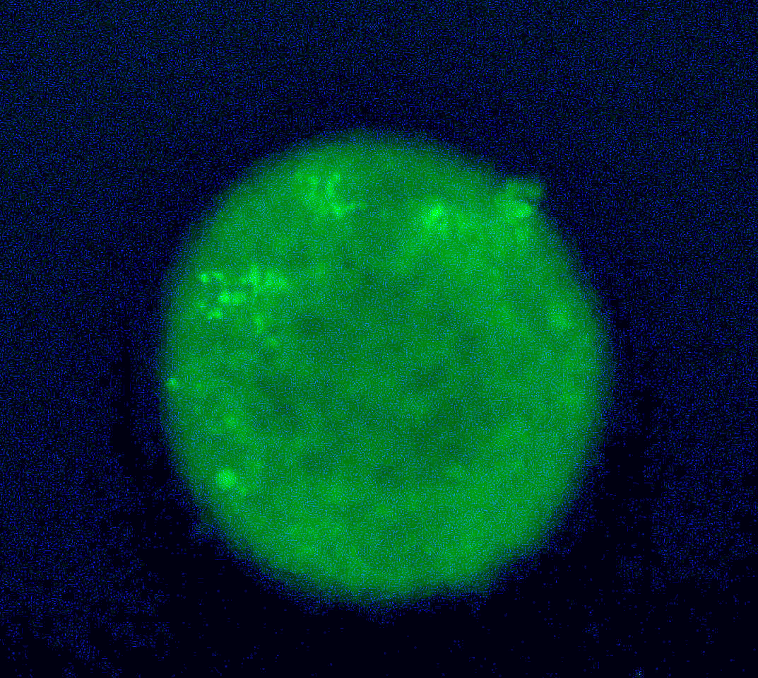 Exploring the interplay between nutrient and oxygen sensing in cells